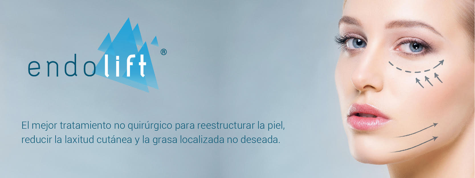 Endolift en Cosmeceutical Center