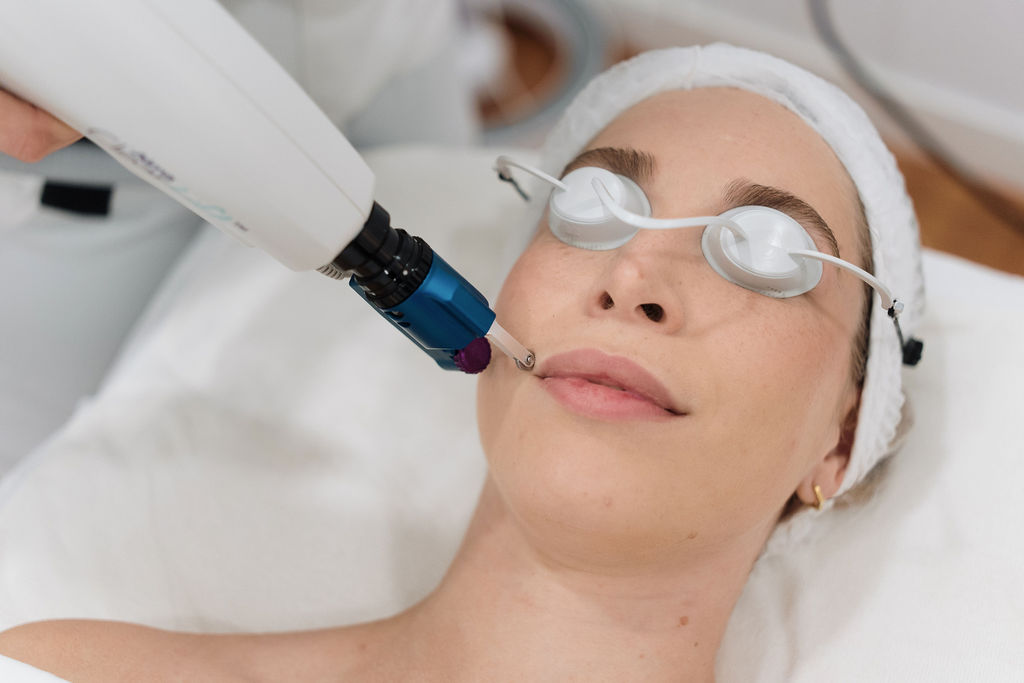 Manchas: ahora es el momento
