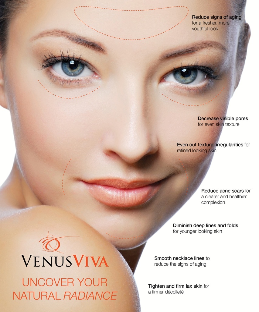 Venus Viva