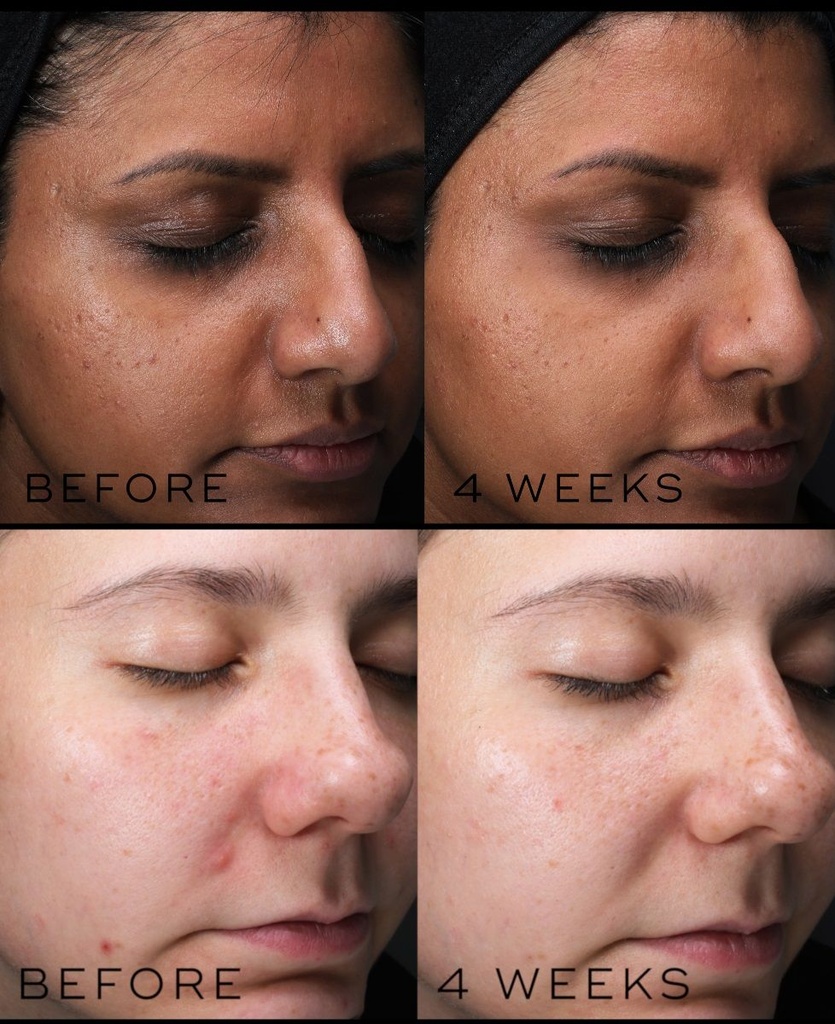 Clarity Peptides de la marca MEDIK8: Resultados 1