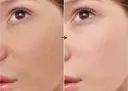L-ascórbico (vitamina C) 7% de la marca Universkin: Resultados