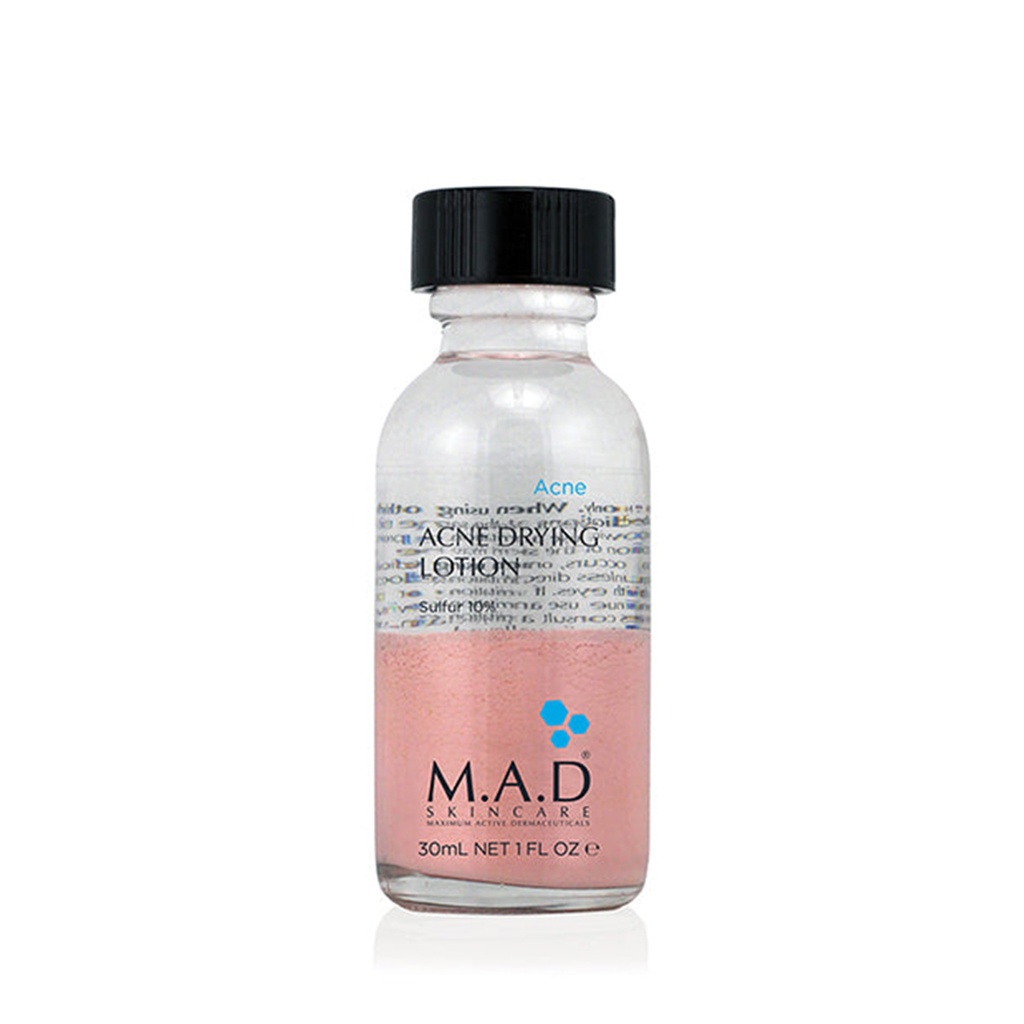 Acne Drying Lotion